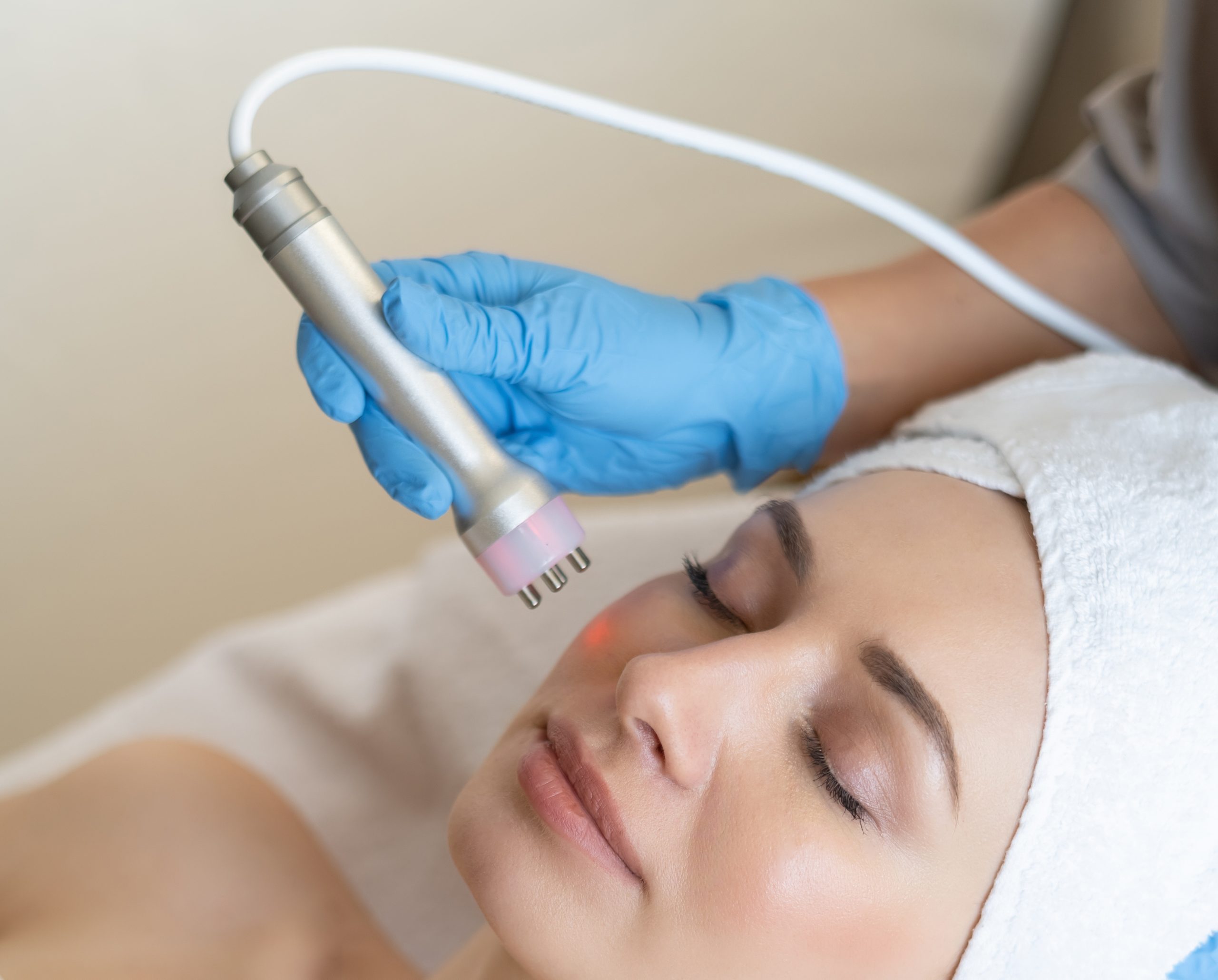 Zabiegi SkinPen Wrocław