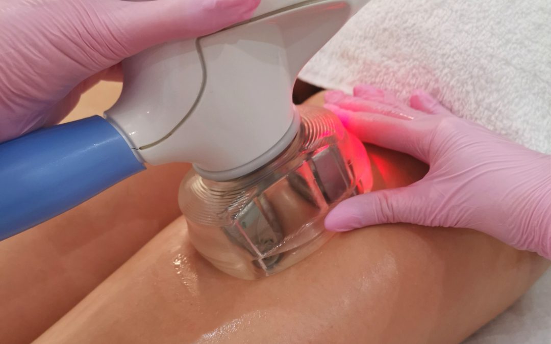 Cellulit- Jak skutecznie się go pozbyć?